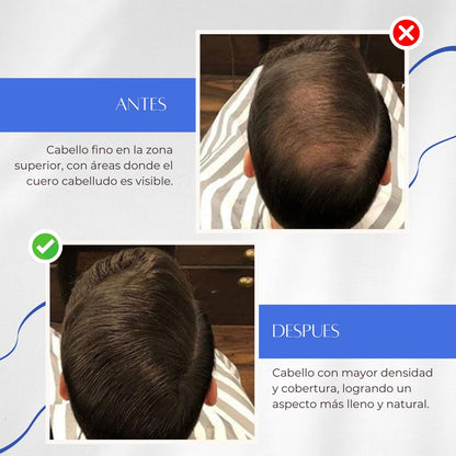 FIBERTHICK Toppik™ - Fibras Capilares, Volumen al instante