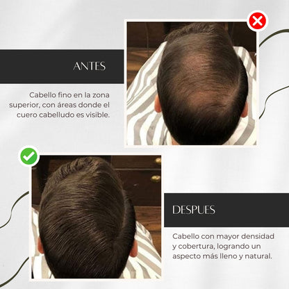 KERAVITÉ Toppik™ - Fibras Capilares, Volumen al instante